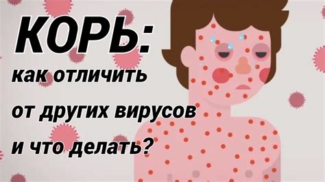 Как московские дачники случайно привезли корь во Владимирскую область